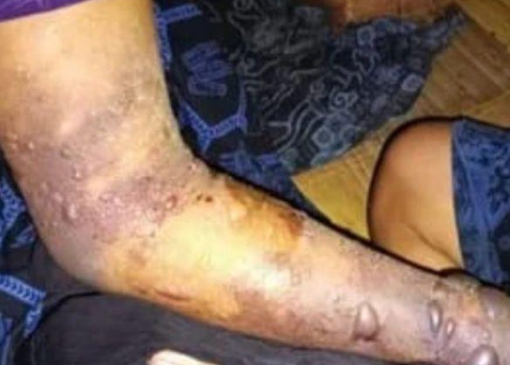 Gigitan Ular Tanah Tewaskan 7 Warga Suku Baduy
